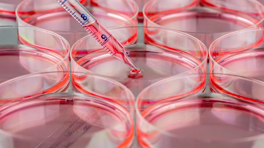 Human Peripheral Blood Lymphocytes