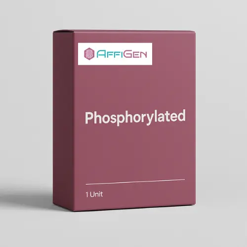 [ABF0016] Phospho- Akt (Ser473)  Antibody - 100µg